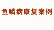 厦门鱼鳞病皮肤科在哪厦门广肤门诊厦门市鱼鳞病皮肤科原创完整版视频在线观看爱奇艺