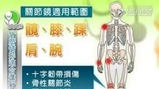 认识关节镜韧带重建手术生活完整版视频在线观看爱奇艺