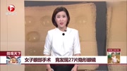 女子眼中取出27个隐形眼镜 自己毫无察觉!资讯搜索最新资讯爱奇艺