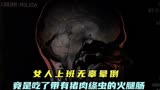 女人上班无辜晕倒，原因竟是吃了带有猪肉绦虫的火腿，豪斯医生！