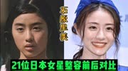 21位日本女星整容前后对比，石原里美堪称模板，新垣结衣判若两人