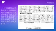 胎儿监护临床使用规范健康完整版视频在线观看爱奇艺