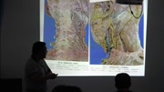 贾文义老师软组织外科学与银质针技术培训班教学片断知识名师课堂爱奇艺