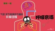 慢性支气管炎是怎么回事?有哪些典型的症状表现?原创完整版视频在线观看爱奇艺