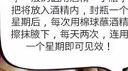 狐臭的小妙招,医生不告诉你的办法生活完整版视频在线观看爱奇艺