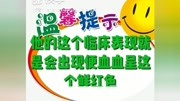 我是张医生,每天持续分享健康知识,关注医生,关注健康,感谢支持.原创高清正版视频在线观看–爱奇艺