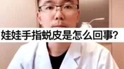 川派好中医徐博士解答:娃娃手指蜕皮是怎么回事?健康高清正版视频在线观看–爱奇艺