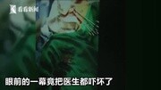 【视频】印度一男子胃痛就医 医生竟取出40把刀具资讯完整版视频在线观看爱奇艺