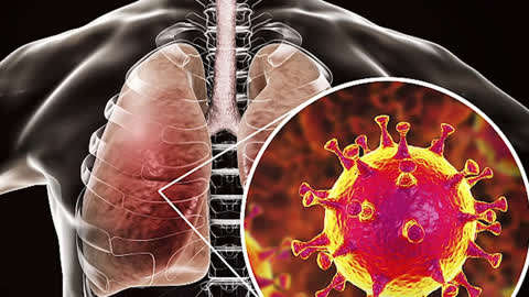新冠解剖肺部图片图片