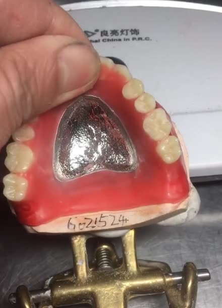矫正牙齿上颚支架图片