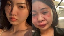 亚裔美女模特地铁站遭殴打猥亵，鼻青脸肿满腿血污，恶心一幕曝光