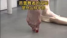 芭蕾舞者的脚趾头，是什么样子的