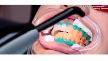 牙医教你如何做牙齿美容？-Dentists-Cosmetic