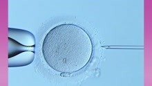 ICSI ，卵胞浆内单精子显微注射技术 ，即第二代“试管婴儿”。