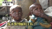 非洲刚果，难民营里七个儿童，母亲无力养活，孩子饿到吸润手指